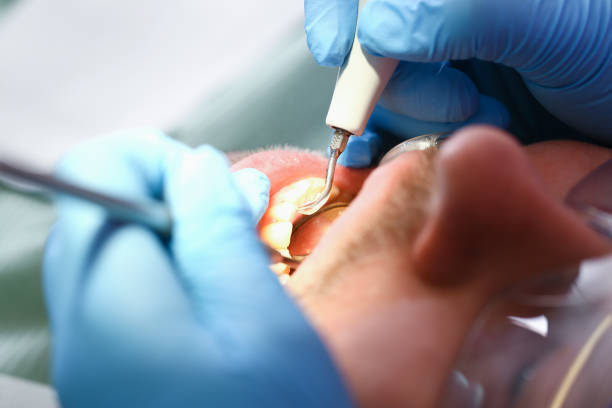 Best Tooth Infection Emergency Dentist  in Great Falls, VA